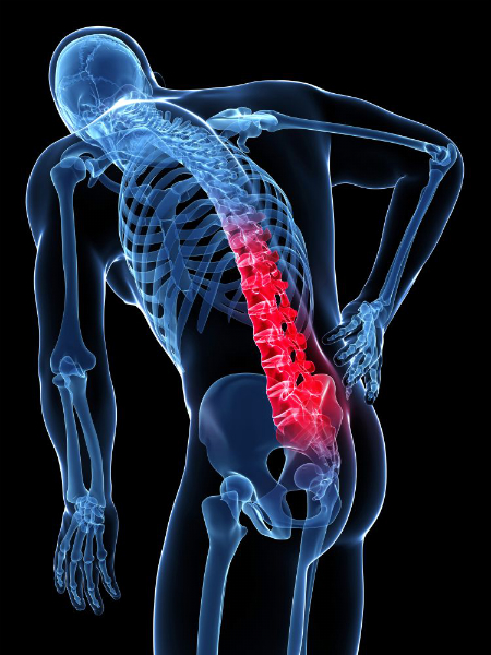 What is Back Pain? Types, Symptoms, Causes, Diagnosis and Treatments