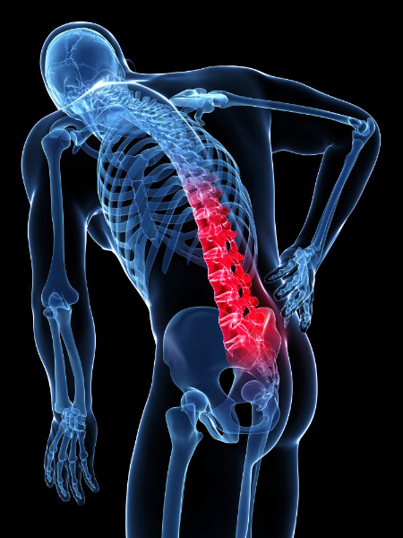 back-pain
