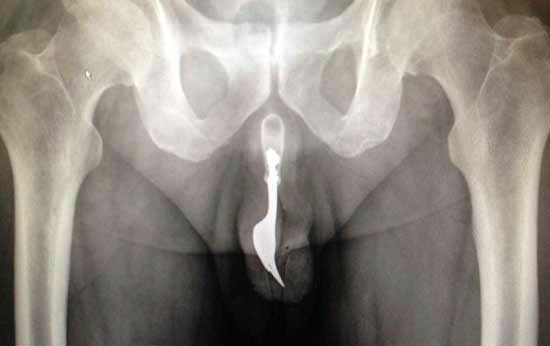 Urethral Masturbation 8