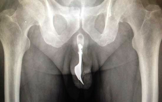 Problems Of Masturbation 57