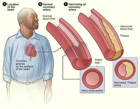 smoking-effects-heart-diseases