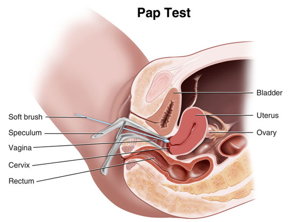 Having Sex Before A Pap Smear 115
