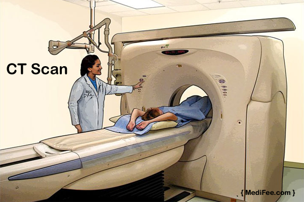 Things You Should Know About CT Scan Procedure,Cost