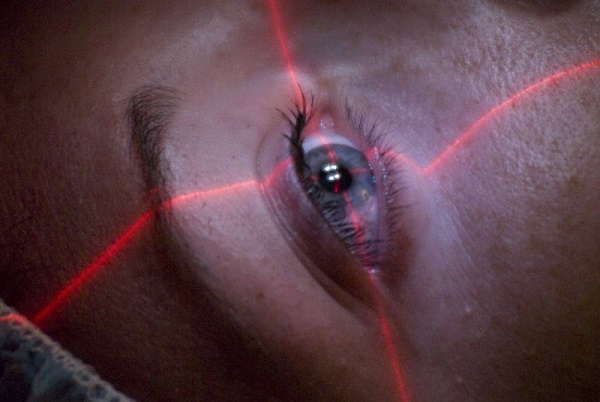 Laser treatment eye Aesthetic Laser