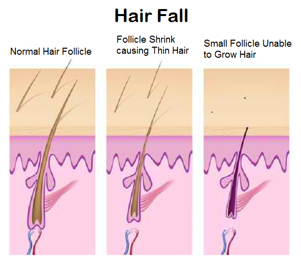 causes-of-hair-fall