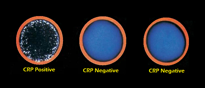 c-rective-protein-test