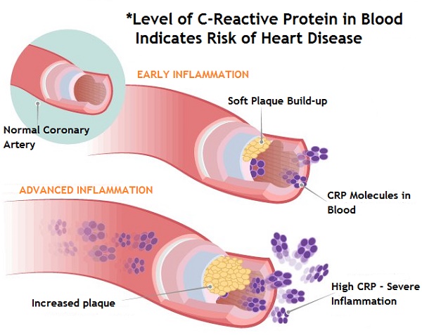 How can you get your CRP to test in the normal range?