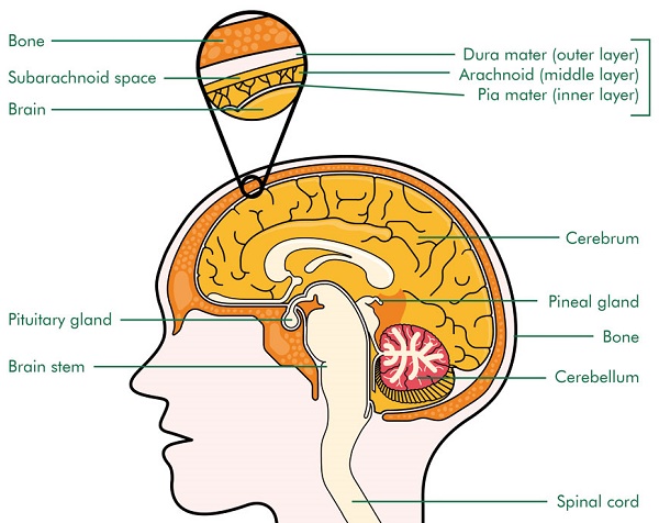 tumour-of-pineal-gland