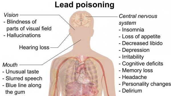 Lead Poisoning Disorders 