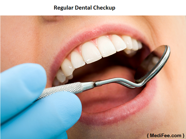 benefits of regular dental checkups