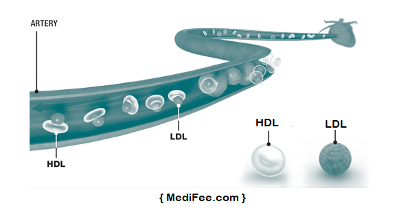 types-of-cholesterol-HDL-LDL