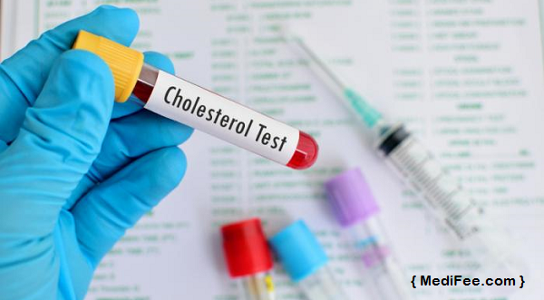 cholesterol-test-medifee