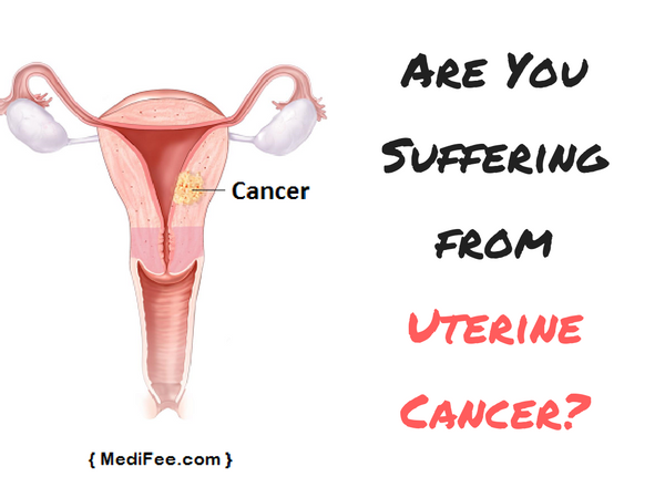 endometrial-uterine-cancer