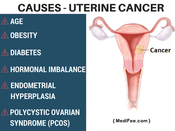 uterine-cancer-causes