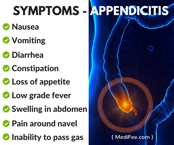 appendicitis-symptoms-medifee
