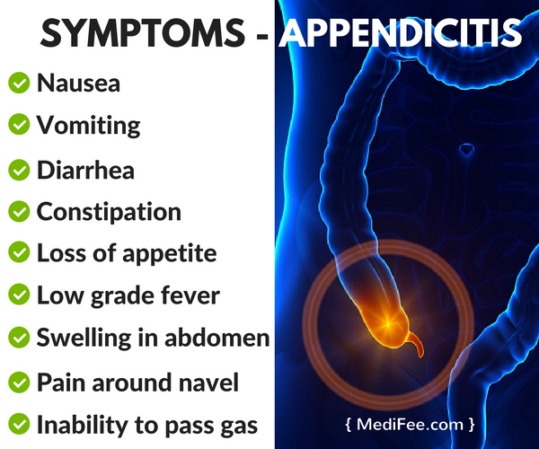 What Is Appendicitis Here Are Its Signs Causes And Tr