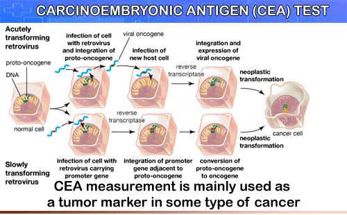 Cea levels colon cancer