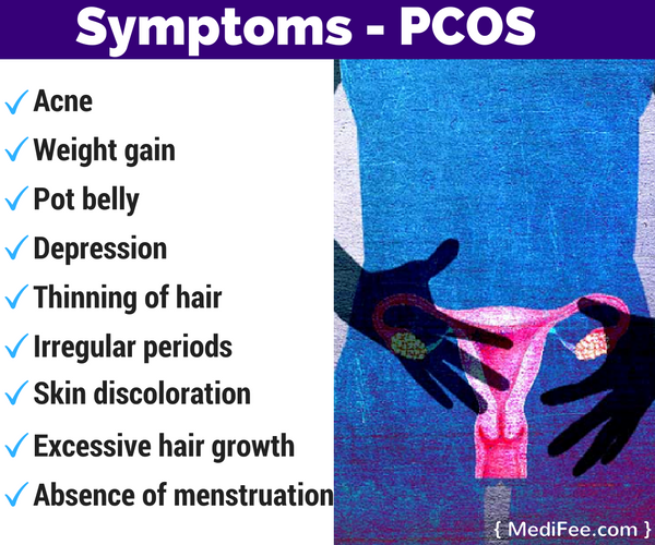 PCOS-signs-and-symptoms