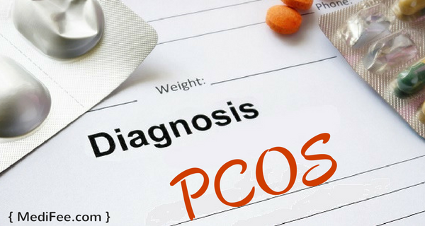 PCOS-diagnosis