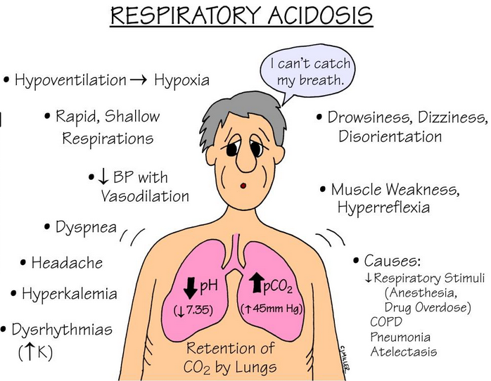 Respiratory_Acidosis
