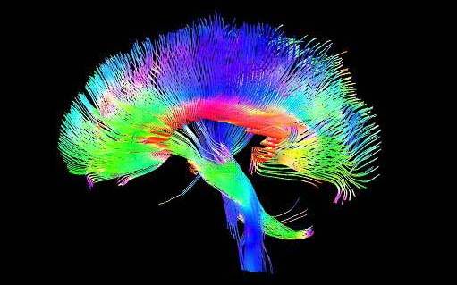 DTI-of-white-matter-in-the-brain