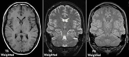 Multinuclear-Imaging