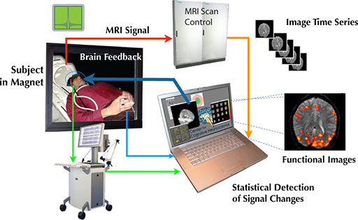 Real-Time-MRI