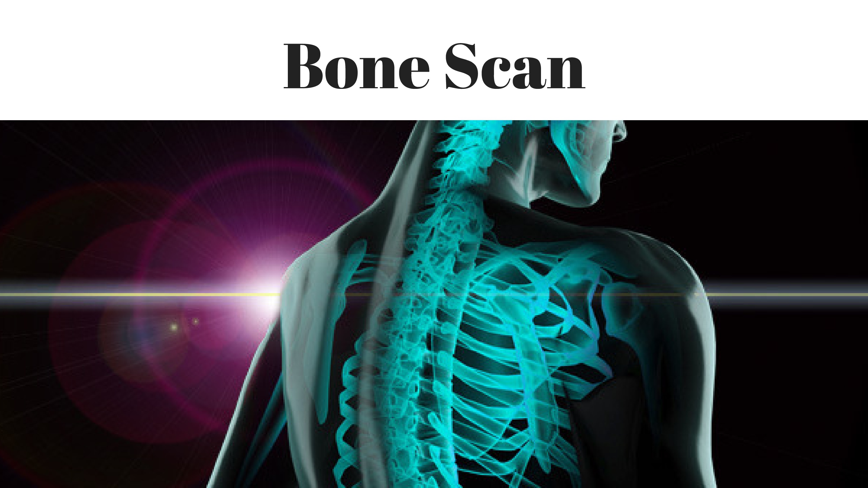 CANCER-Bone-Scan