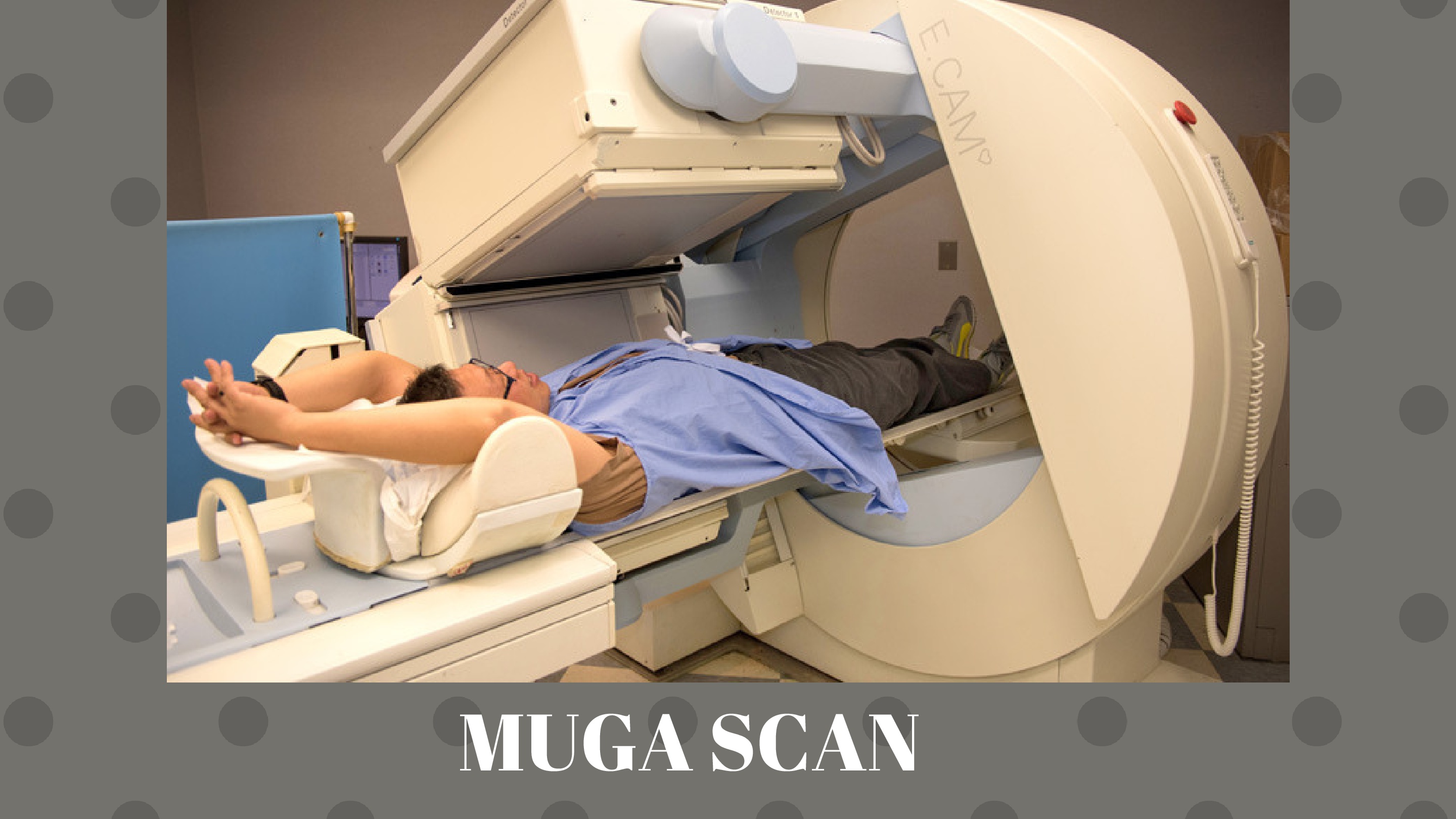 CANCER-MUGA-Scan
