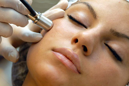 Diamond-Tip-Microdermabrasion