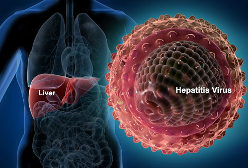 Viral-Hepatitis