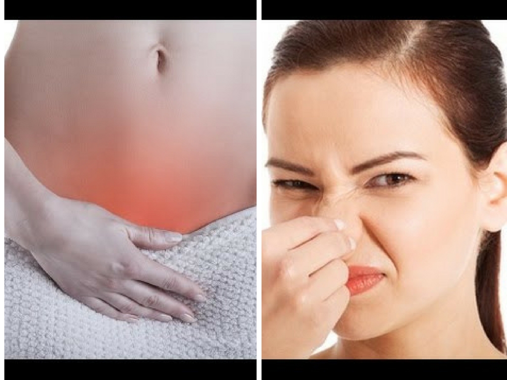 Bacterial-vaginosis