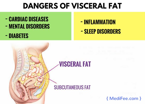 visceral-fat-and-health-disorders