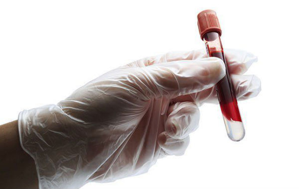 Types of blood test