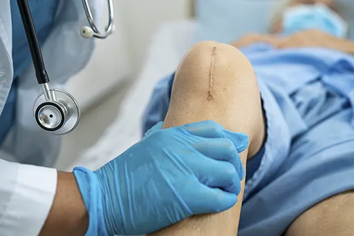 Knee Replacement Surgery