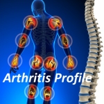 Arthritis Profile Test