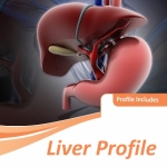 Liver Profile Test