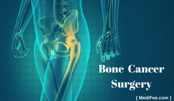 bone cancer