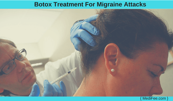 botox treatment for migraine attacks