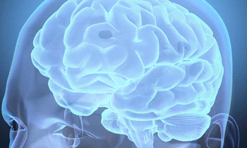 Brain Mapping Brain Mapping