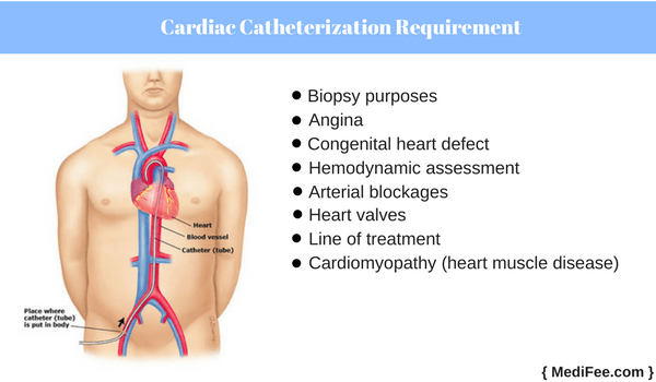 why is cardiac catheterization required