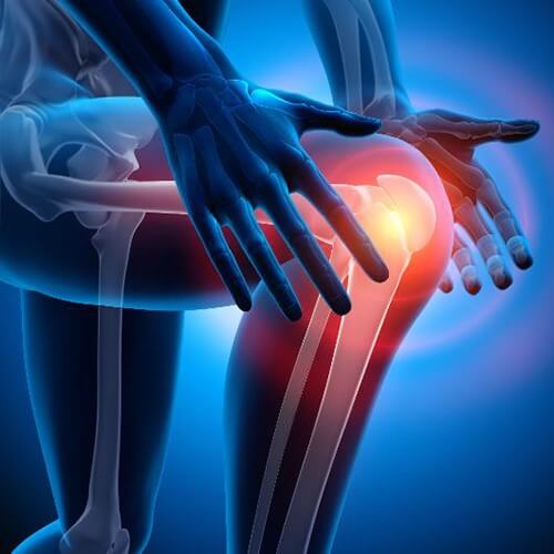 knee arthroplasty knee arthroplasty