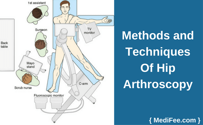 method of hip arthroscopy