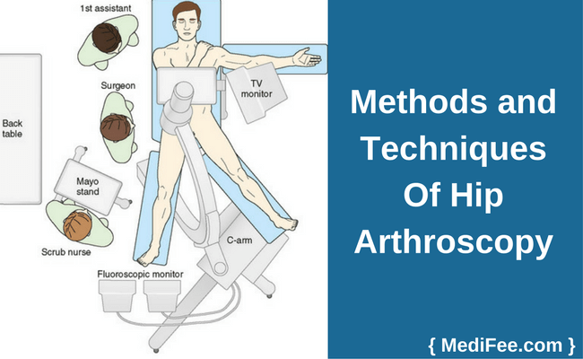 method of hip arthroscopy method of hip arthroscopy