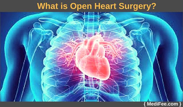 open heart surgery