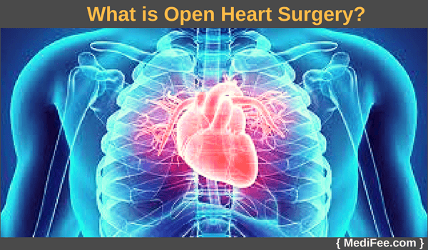 open heart surgery open heart surgery