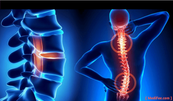 surgery of spine