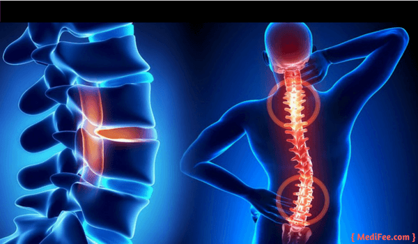 spine surgery surgery of spine