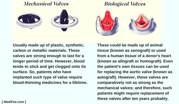 mechanical and biological valves used in aortic valve replacement surgery