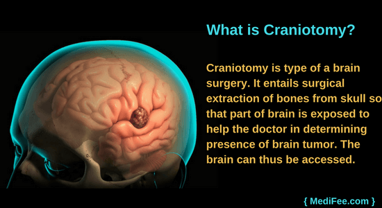 craniotomy what is craniotomy